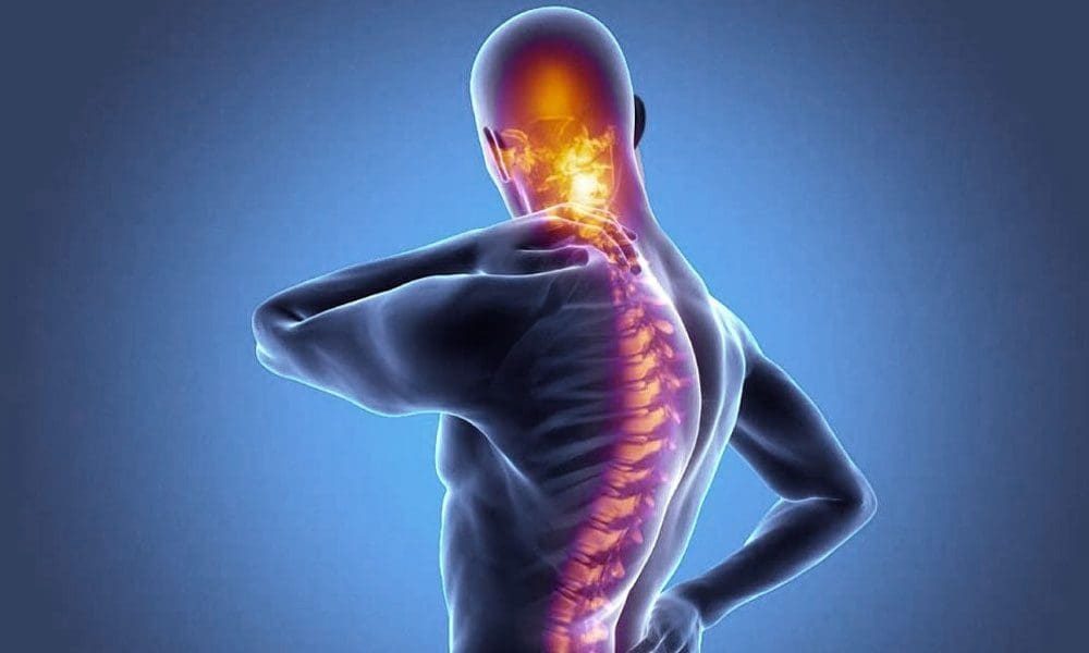 Ankylozujúca spondylitída a mozgová hmla: Lekárska chiropraktika pri úrazoch