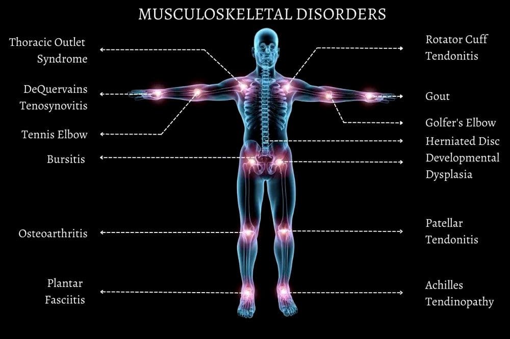 Fatica ed esaurimento: lesioni mediche chiropratiche