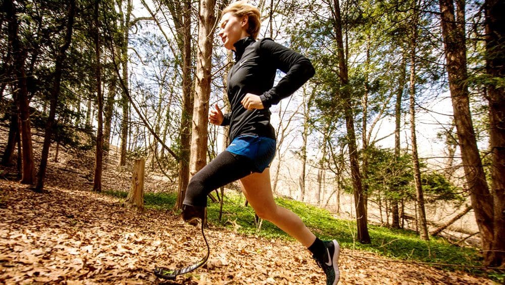 Running With Prosthetic Leg: Injury Medical Chiropractic Team