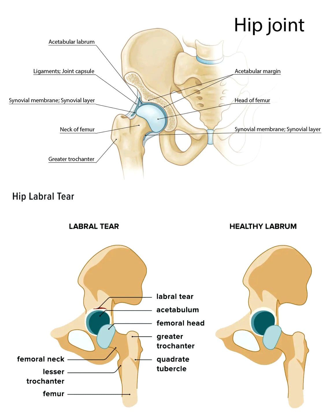 Testên Hêsirê yên Hip Labral: Tîma Chiropractic EPs