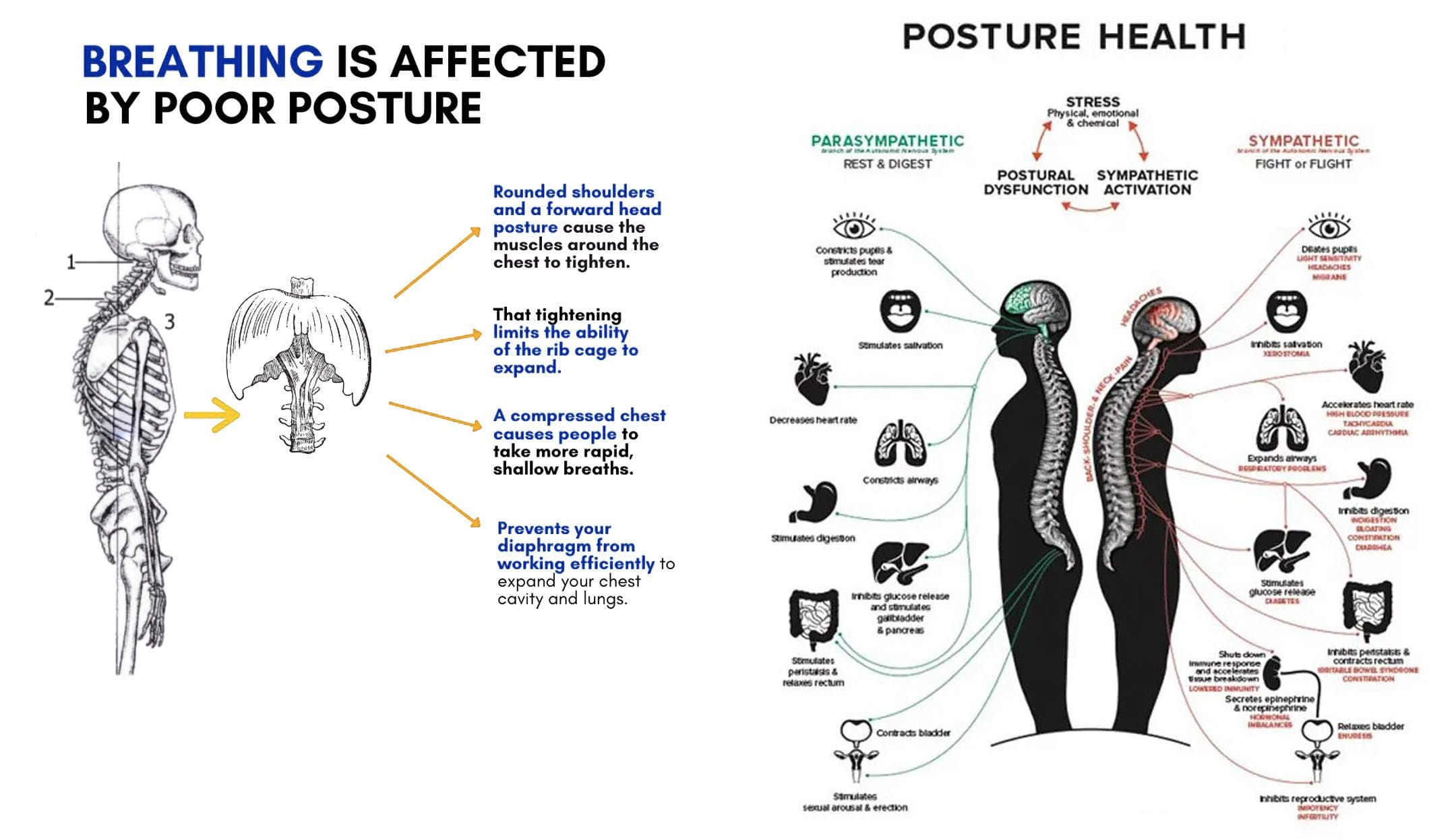 Breathing and Posture: EP's Chiropractic Team 