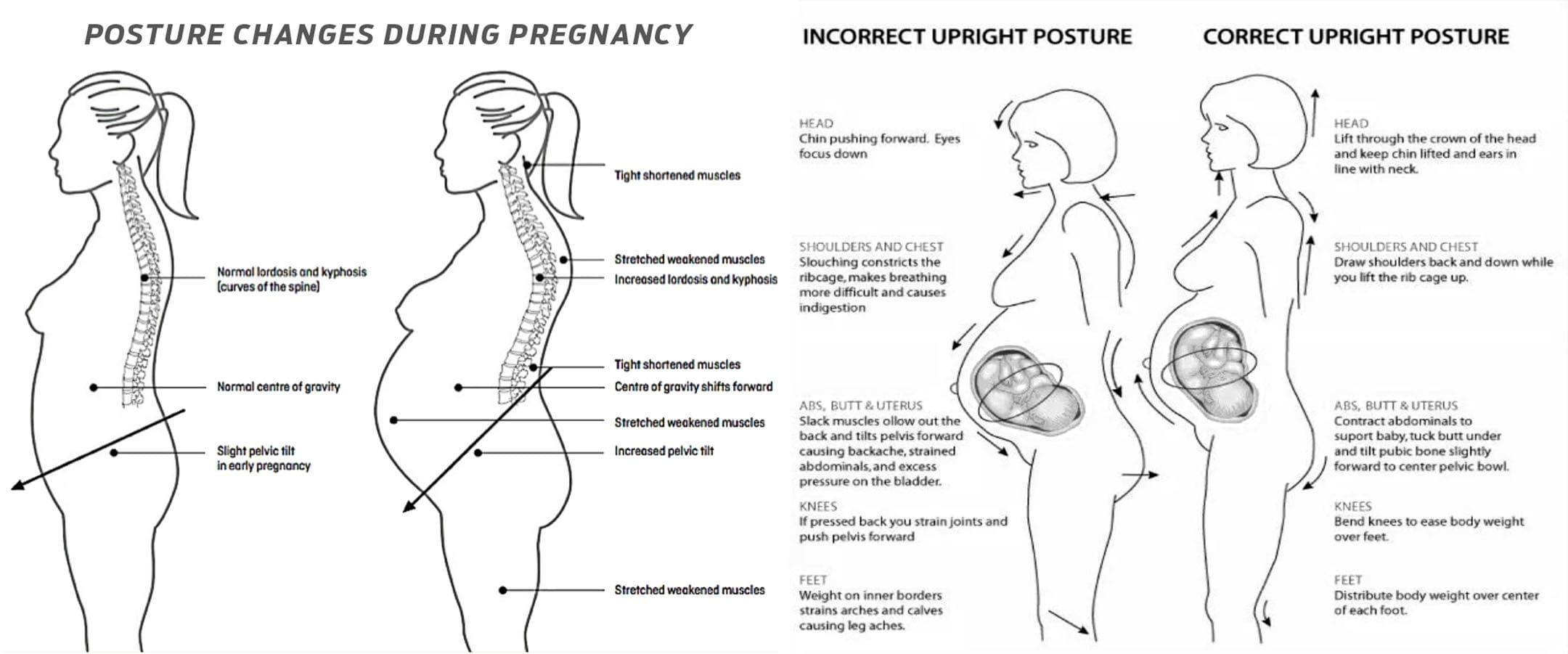 Pregnancy Posture Health: EP Chiropractic Functional Team