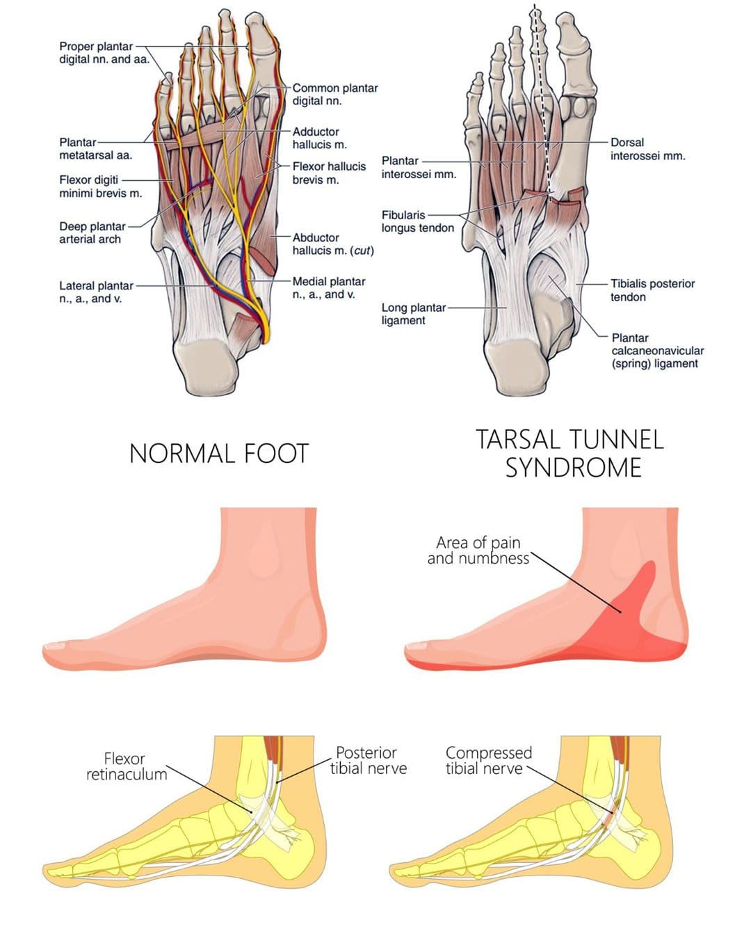 Can Sciatica Cause Foot Pain?