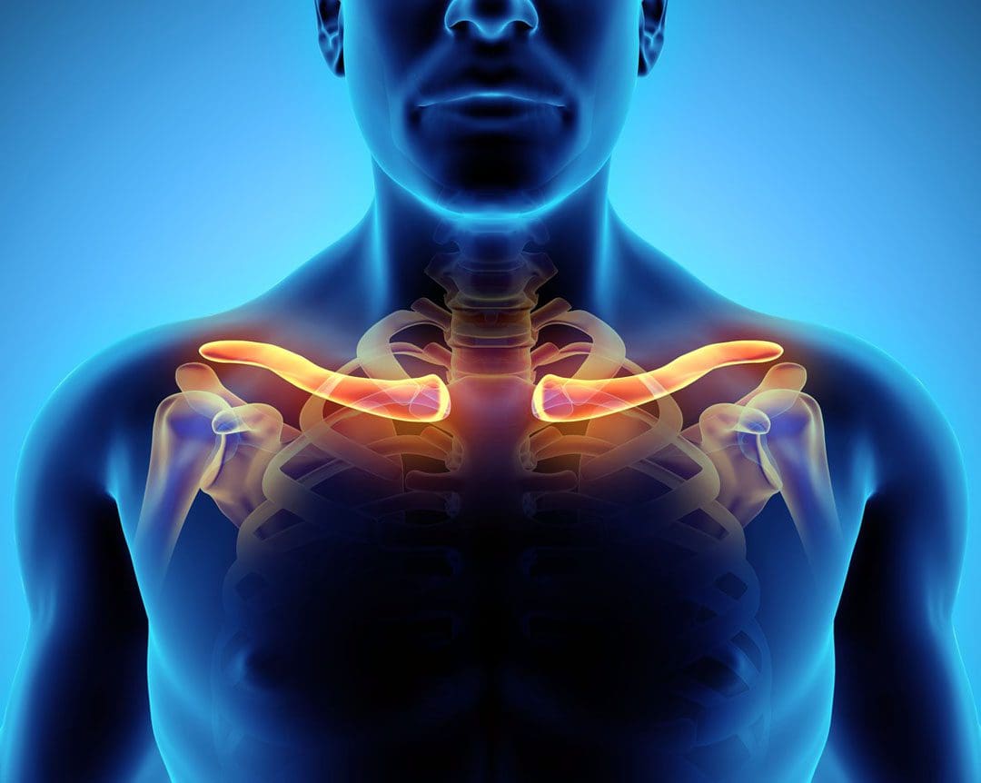 Symptoms and Treatment for Broken Collarbones