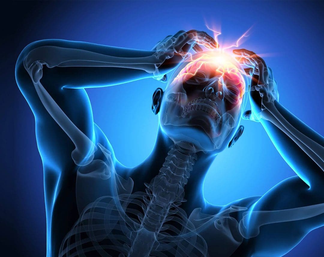 The Real Culprit of Headache On Top Of The Head: How To Treat It