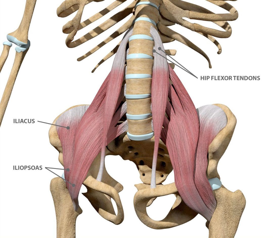 Comprensione della sindrome dell'ileopsoas: sintomi e cause