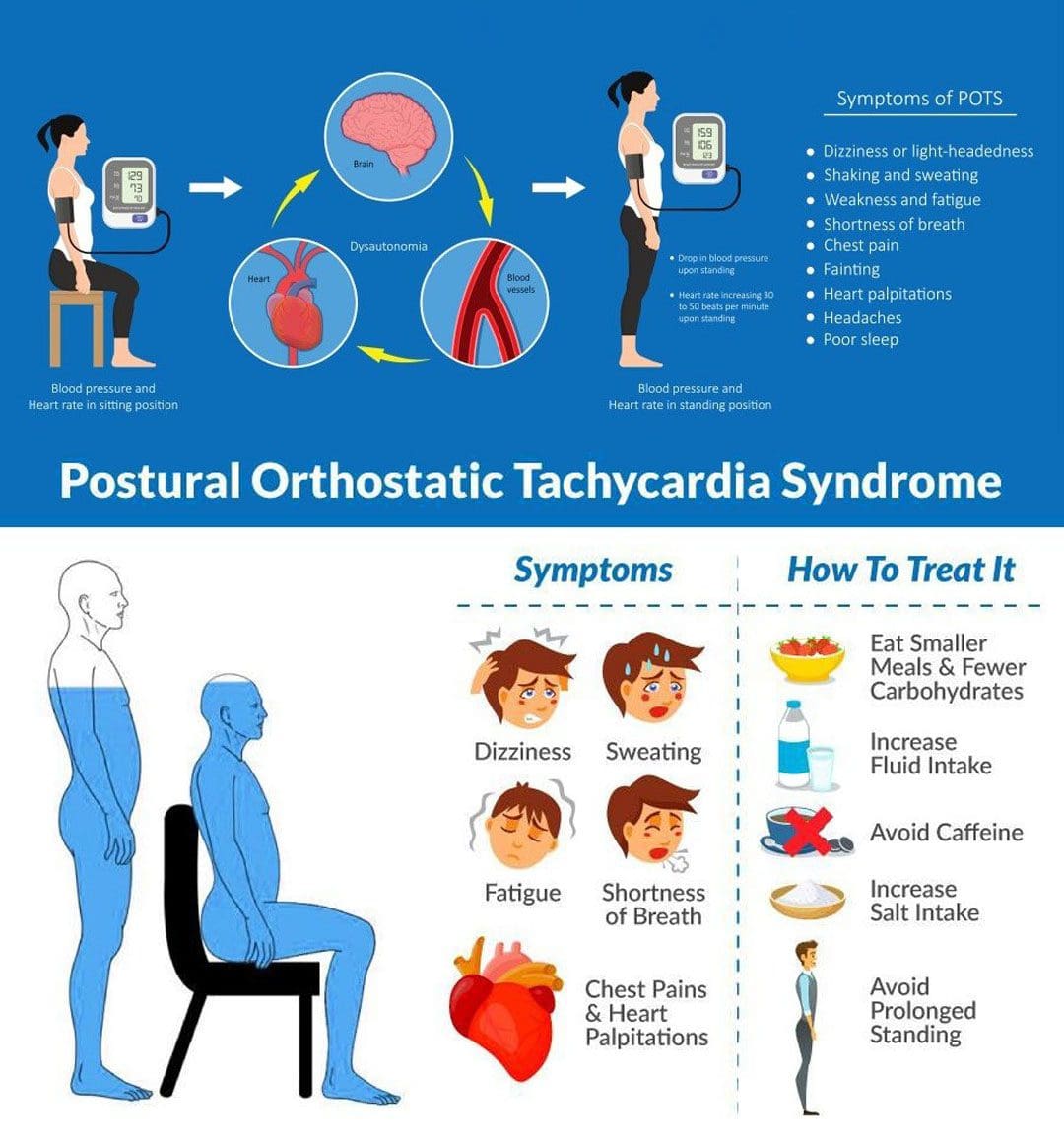 Tips For Managing Postural Orthostatic Tachycardia Syndrome