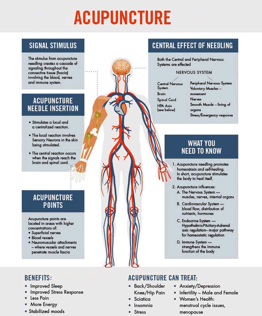 Learn About Acupuncture Pain Management A Complete Guide El Paso s 