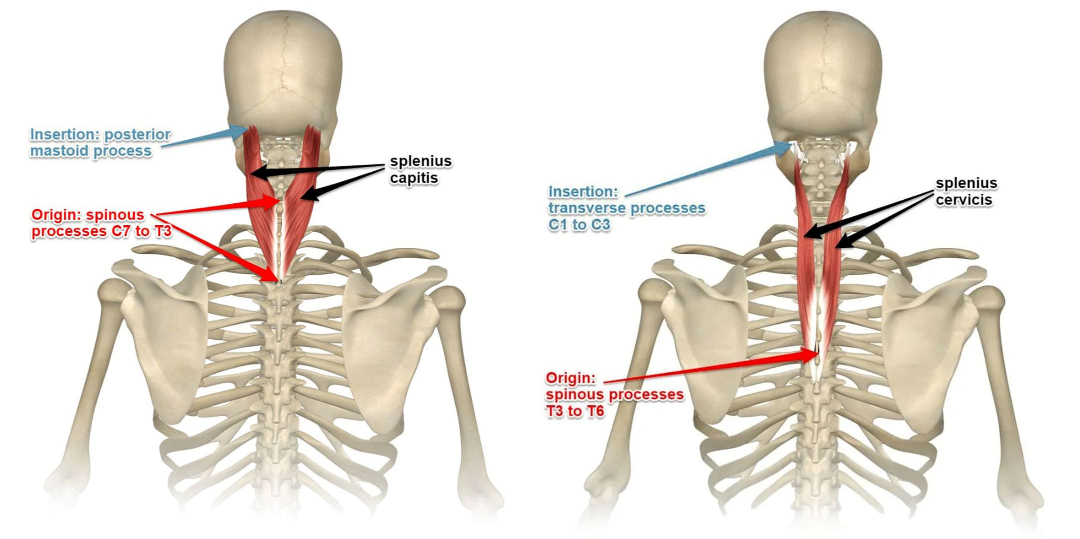 Keeping your Posture Right: All about the Splenius Capitis