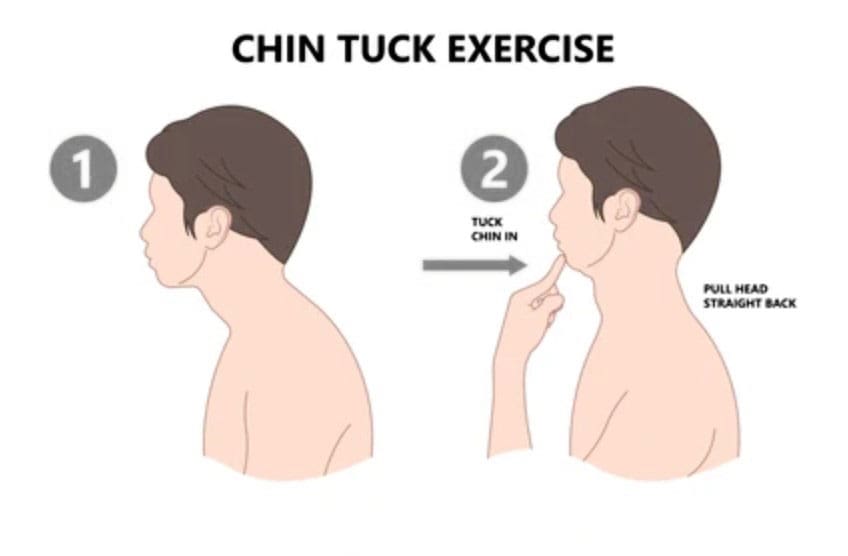 Enhance Neck Mobility with Cervical Retraction Exercise