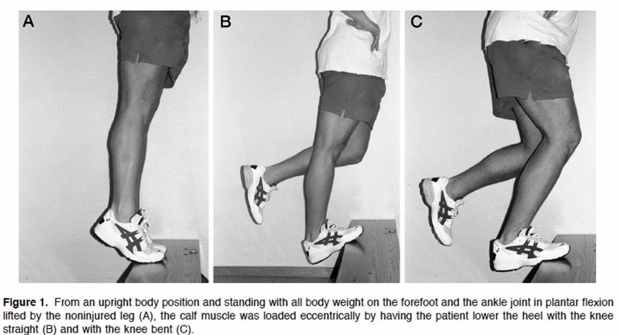 Effective Exercise Protocol for Managing Achilles Tendonitis