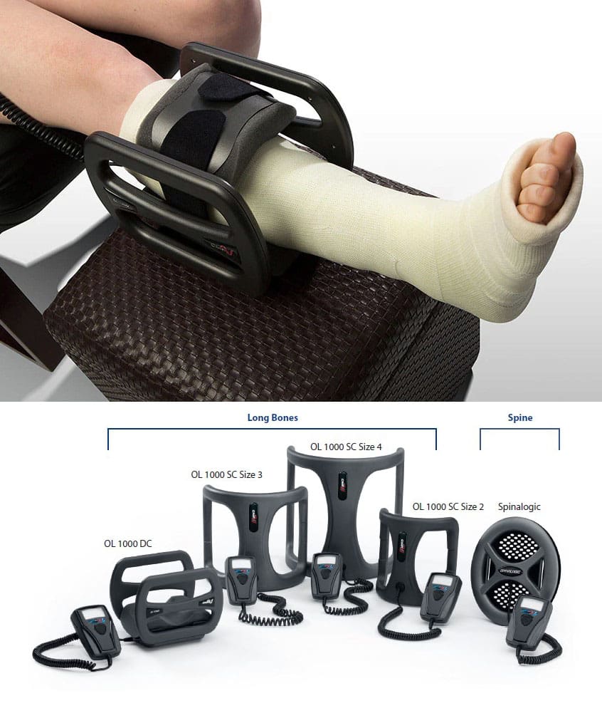 Bone Growth Stimulator Use in Delayed Healing Cases